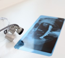 Bild Zahnarzt Berlin - Kiefergelenkserkrankung